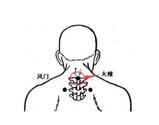 大椎的准确位置图和作用