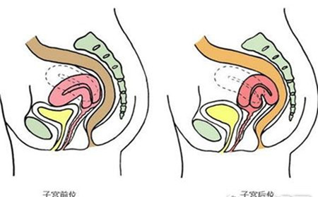子宫前位是男孩吗子宫前位生男孩比例子宫前位有什么危害
