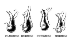 寶寶蛋蛋有積液怎麼辦蛋蛋有積液治療方法